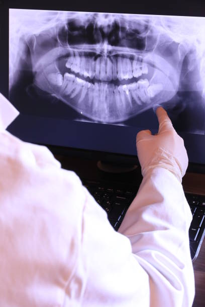 Best Broken or Cracked Tooth Emergency Dentist in Georgetown, IN