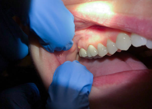 Best Holiday Emergency Dentist in Georgetown, IN